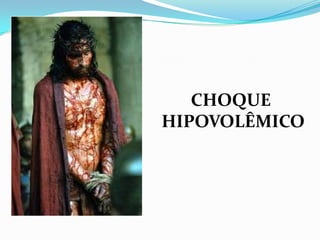 CHOQUE
HIPOVOLÊMICO
 