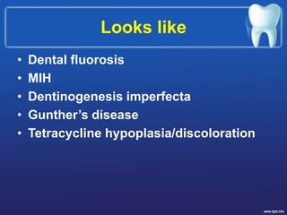 Looks like
• Dental fluorosis
• MIH
• Dentinogenesis imperfecta
• Gunther’s disease
• Tetracycline hypoplasia/discoloration
 