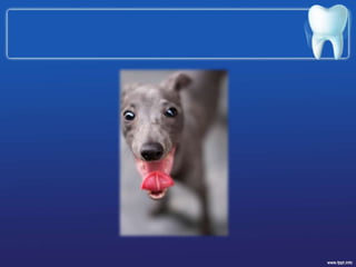 Amelogenesis imperfecta