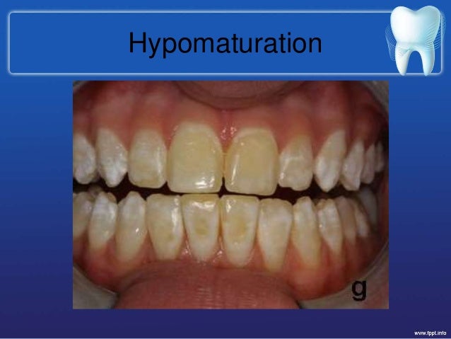 hypomaturation 19