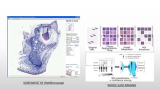 SCREENSHOT OF WebMicroscope
WHOLE SLIDE IMAGING
 