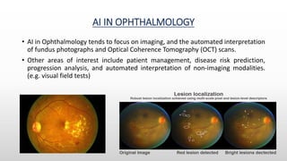 AI IN OPHTHALMOLOGY
• AI in Ophthalmology tends to focus on imaging, and the automated interpretation
of fundus photographs and Optical Coherence Tomography (OCT) scans.
• Other areas of interest include patient management, disease risk prediction,
progression analysis, and automated interpretation of non-imaging modalities.
(e.g. visual field tests)
 