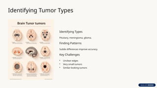 AI-Driven Early Detection and Classification of Brain Tumors Using ...