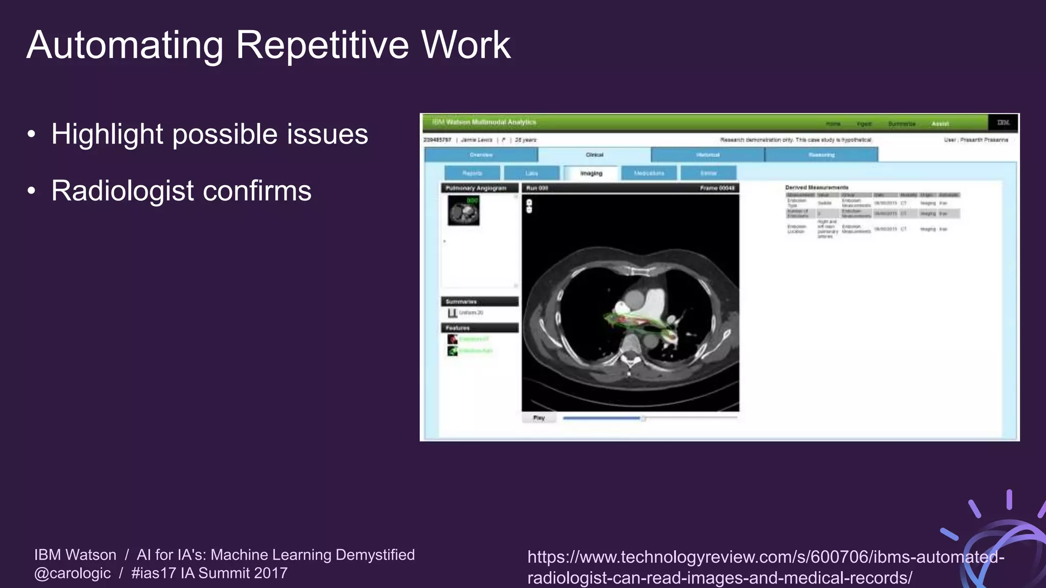 IBM Watson / AI for IA's: Machine Learning Demystified
@carologic / #ias17 IA Summit 2017
Automating Repetitive Work
• Highlight possible issues
• Radiologist confirms
https://www.technologyreview.com/s/600706/ibms-automated-
radiologist-can-read-images-and-medical-records/
 