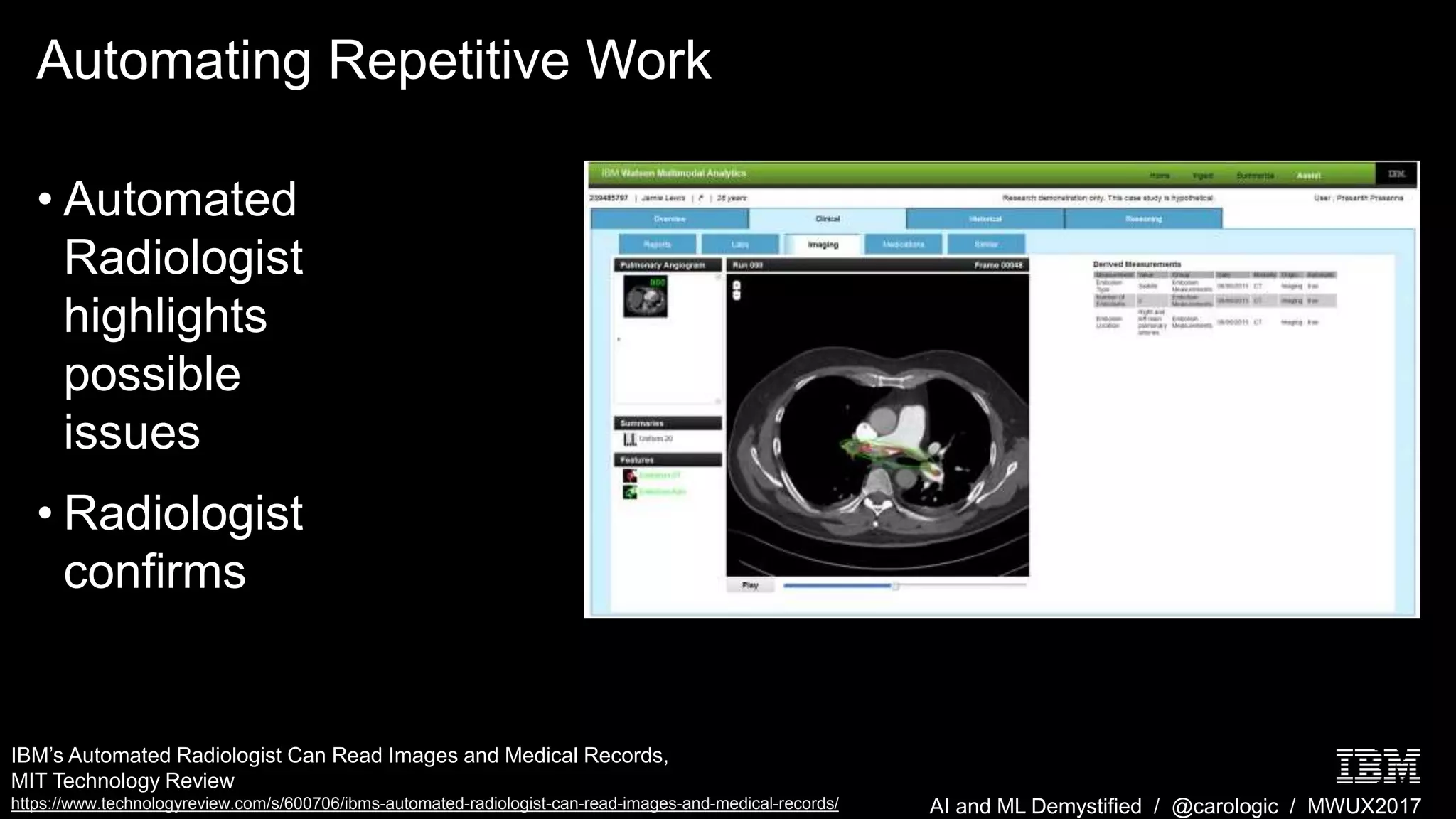 AI and ML Demystified / @carologic / MWUX2017
Automating Repetitive Work
• Automated
Radiologist
highlights
possible
issues
• Radiologist
confirms
IBM’s Automated Radiologist Can Read Images and Medical Records,
MIT Technology Review
https://www.technologyreview.com/s/600706/ibms-automated-radiologist-can-read-images-and-medical-records/
 