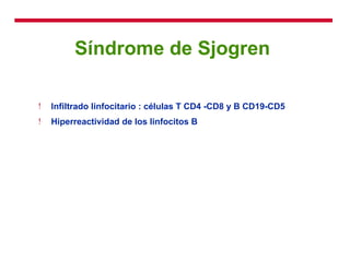 Síndrome de Sjogren  Infiltrado linfocitario : células T CD4 -CD8 y B CD19-CD5 Hiperreactividad de los linfocitos B 