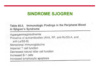 SINDROME SJOGREN 