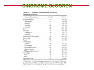 SINDROME SJOGREN 