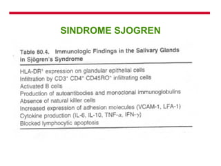SINDROME SJOGREN 