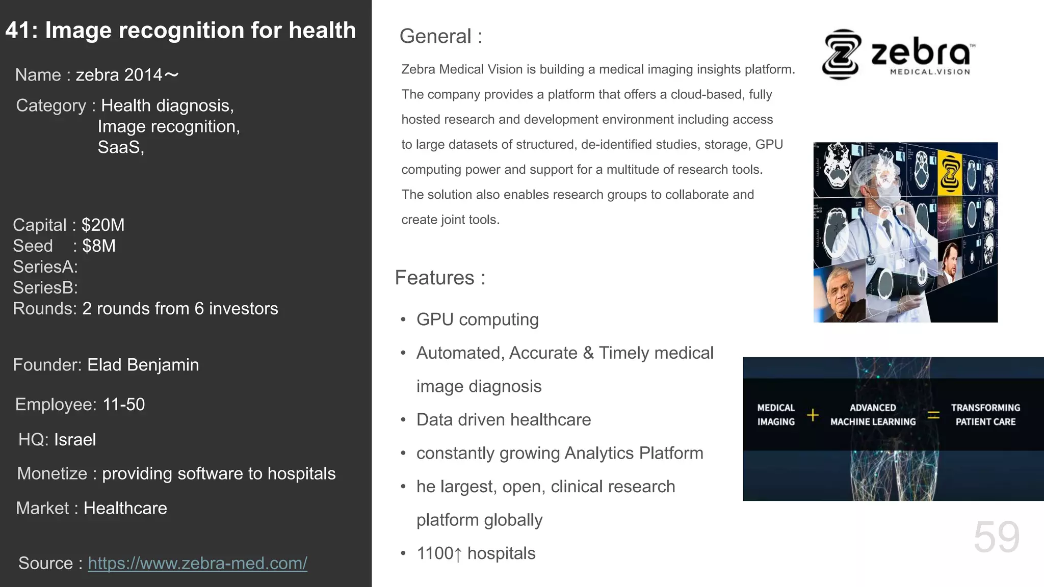 59
Zebra Medical Vision is building a medical imaging insights platform.
The company provides a platform that offers a cloud-based, fully
hosted research and development environment including access
to large datasets of structured, de-identified studies, storage, GPU
computing power and support for a multitude of research tools.
The solution also enables research groups to collaborate and
create joint tools.
General :41: Image recognition for health
Category : Health diagnosis,
Image recognition,
SaaS,
Capital : $20M
Seed : $8M
SeriesA:
SeriesB:
Rounds: 2 rounds from 6 investors
Monetize : providing software to hospitals
Founder: Elad Benjamin
Name : zebra 2014〜
HQ: Israel
Employee: 11-50
Source : https://www.zebra-med.com/
Features :
• GPU computing
• Automated, Accurate & Timely medical
image diagnosis
• Data driven healthcare
• constantly growing Analytics Platform
• he largest, open, clinical research
platform globally
• 1100↑ hospitals
Market : Healthcare
 
