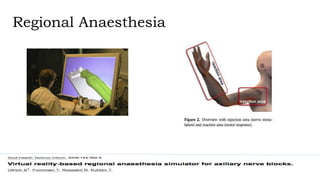 Regional Anaesthesia
 