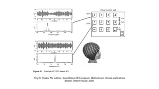 Tong S, Thakor NV, editors. Quantitative EEG analysis: Methods and clinical applications.
Boston: Artech House; 2009.
 