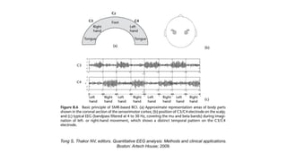 Tong S, Thakor NV, editors. Quantitative EEG analysis: Methods and clinical applications.
Boston: Artech House; 2009.
 