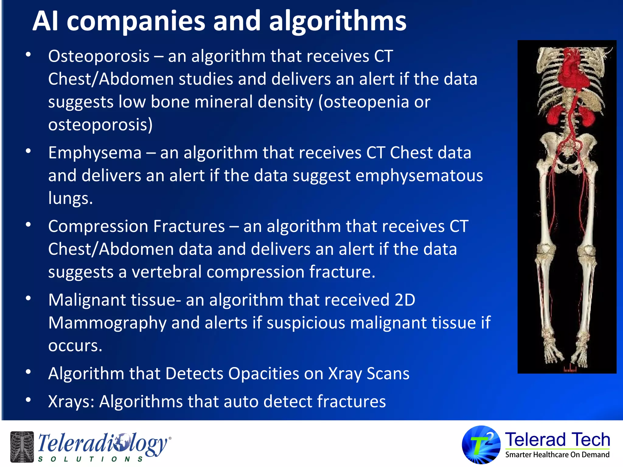 AI companies and algorithms
• Osteoporosis – an algorithm that receives CT
Chest/Abdomen studies and delivers an alert if the data
suggests low bone mineral density (osteopenia or
osteoporosis)
• Emphysema – an algorithm that receives CT Chest data
and delivers an alert if the data suggest emphysematous
lungs.
• Compression Fractures – an algorithm that receives CT
Chest/Abdomen data and delivers an alert if the data
suggests a vertebral compression fracture.
• Malignant tissue- an algorithm that received 2D
Mammography and alerts if suspicious malignant tissue if
occurs.
• Algorithm that Detects Opacities on Xray Scans
• Xrays: Algorithms that auto detect fractures
 