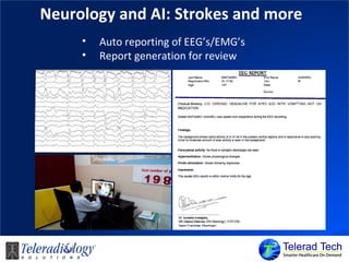 Neurology and AI: Strokes and more
• Auto reporting of EEG’s/EMG’s
• Report generation for review
 