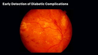 Early Detection of Diabetic Complications
 