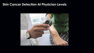 Skin Cancer Detection At Physician-Levels
 