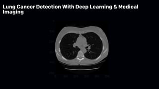 Lung Cancer Detection With Deep Learning & Medical
Imaging
 