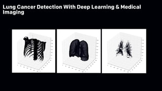Lung Cancer Detection With Deep Learning & Medical
Imaging
 
