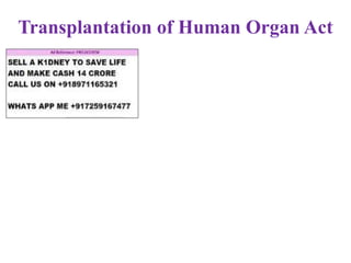 Transplantation of Human Organ Act
 