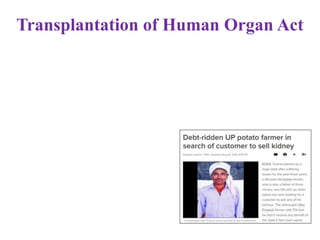 Transplantation of Human Organ Act
 