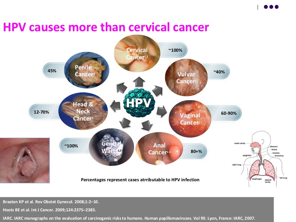 CANCER CERVIX BURDEN OF HPV