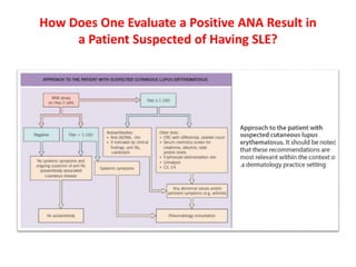 Auto antibodies in Autoimmune Connective Tissue Diseases | PPTX