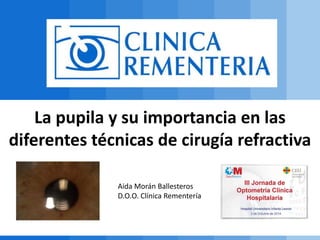 La pupila y su importancia en las 
diferentes técnicas de cirugía refractiva 
Aida Morán Ballesteros 
D.O.O. Clínica Rementería 
 