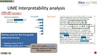 Classification of prostate cancer pathology reports using natural language processing