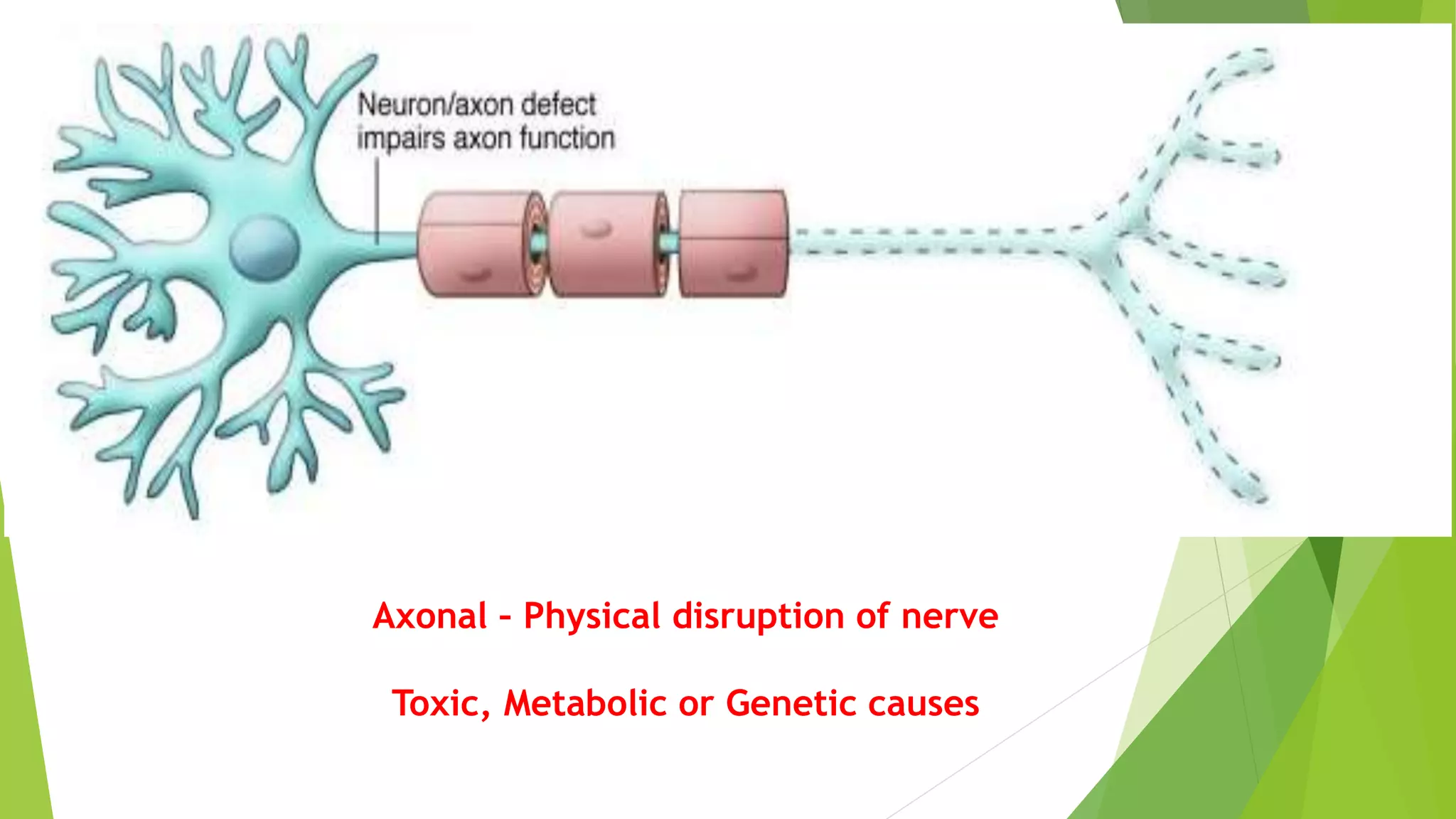 Axonal/ Demyelinating
Axonal – Physical disruption of nerve
Toxic, Metabolic or Genetic causes
 