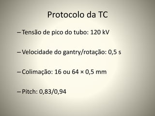 Protocolo da TC
–Tensão de pico do tubo: 120 kV
–Velocidade do gantry/rotação: 0,5 s
–Colimação: 16 ou 64 × 0,5 mm
–Pitch: 0,83/0,94
 