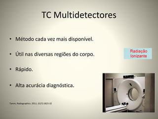 TC Multidetectores
• Método cada vez mais disponível.
• Útil nas diversas regiões do corpo.
• Rápido.
• Alta acurácia diagnóstica.
Tamm, Radiographics. 2011; 31(7):1823-32
 