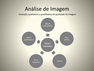 Análise de Imagem
Níveis
avaliados
Ápices
pulmonares
Arco
aórtico
Carina
Átrio
Esquerdo
Bases
pulmonares
Avaliação qualitativa e quantitativa da qualidade de imagem
 