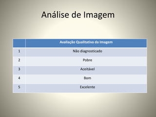 Análise de Imagem
Avaliação Qualitativa da Imagem
1 Não diagnosticado
2 Pobre
3 Aceitável
4 Bom
5 Excelente
 