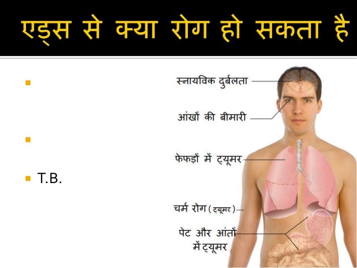 Aids awareness in Hindi