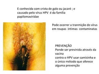 E conhecida com crista de galo ou jacaré ; e causado pelo vírus HPV  é da família papilomaviridaePode ocorrer a tranmição do vírus em roupas  intimas  contaminatasPREVENÇÂOPonde ser previnida através da vacina contra o HPV usar camisinha e o único método que oferece alguma prevenção