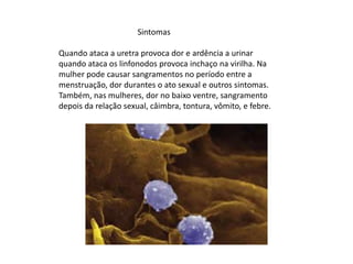                                        SintomasQuando ataca a uretra provoca dor e ardência a urinar quando ataca os linfonodos provoca inchaço na virilha. Na mulher pode causar sangramentos no período entre a menstruação, dor durantes o ato sexual e outros sintomas. Também, nas mulheres, dor no baixo ventre, sangramento depois da relação sexual, câimbra, tontura, vômito, e febre.