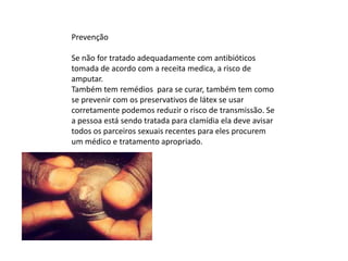 Prevenção Se não for tratado adequadamente com antibióticos tomada de acordo com a receita medica, a risco de amputar.Também tem remédios  para se curar, também tem como se prevenir com os preservativos de látex se usar corretamente podemos reduzir o risco de transmissão. Se a pessoa está sendo tratada para clamídia ela deve avisar todos os parceiros sexuais recentes para eles procurem um médico e tratamento apropriado.