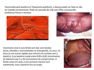 Transmitida pela bactéria (a Treponema pallidum), a doença pode ser fatal se não ser tratada corretamente. Pode ser passada de mãe para filho, provocando problemas físicos e mentais.O primeiro sinal é uma ferida sem dor, com bordas duras, elevadas e avermelhadas na área genital, no anus, na boca ou em outras regiões que entram em contato com a bactéria. Essa bactéria mede entre 0,09 a 0,05 micrometros de diâmetro por 5 a 20 micrometros de comprimento. A ferida some em duas a seis semanas mesmo sem tratamento, mas a bactéria fica no corpo.