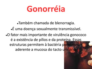 GonorréiaTambém chamada de blenorragia.