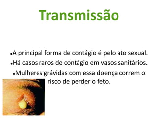 É uma doença sexualmente transmissível.