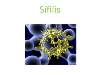 Sífilis
 