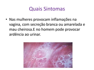 Quais Sintomas
• Nas mulheres provocam inflamações na
  vagina, com secreção branca ou amarelada e
  mau cheirosa.E no homem pode provocar
  ardência ao urinar.
 