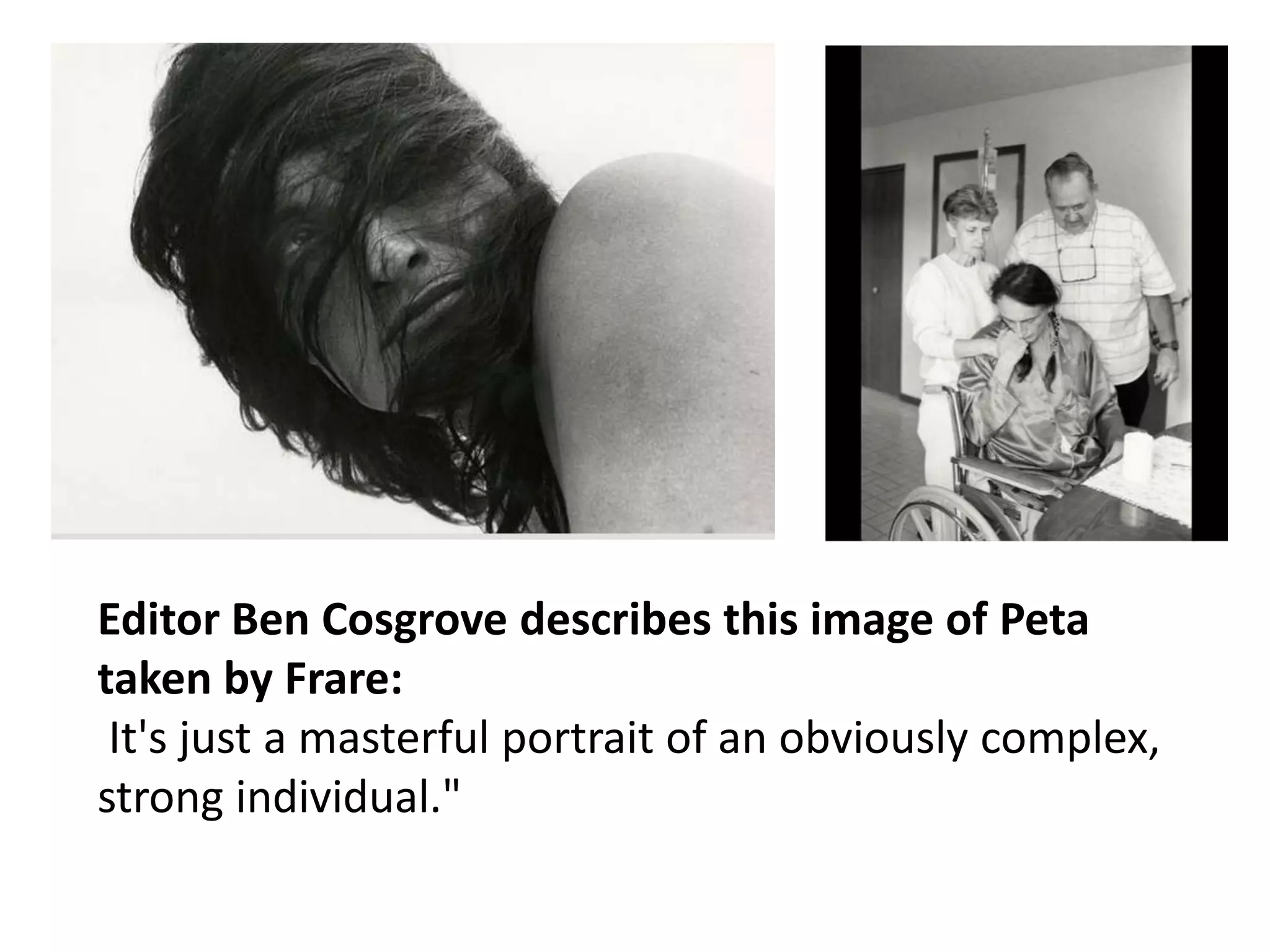 Photos that changed the face of Aids | PPTX