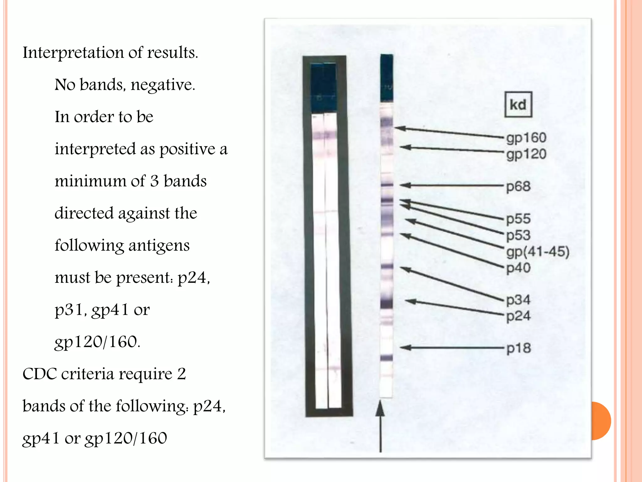 Interpretation of results.
No bands, negative.
In order to be

interpreted as positive a
minimum of 3 bands
directed against the
following antigens
must be present: p24,
p31, gp41 or
gp120/160.
CDC criteria require 2
bands of the following: p24,
gp41 or gp120/160

 