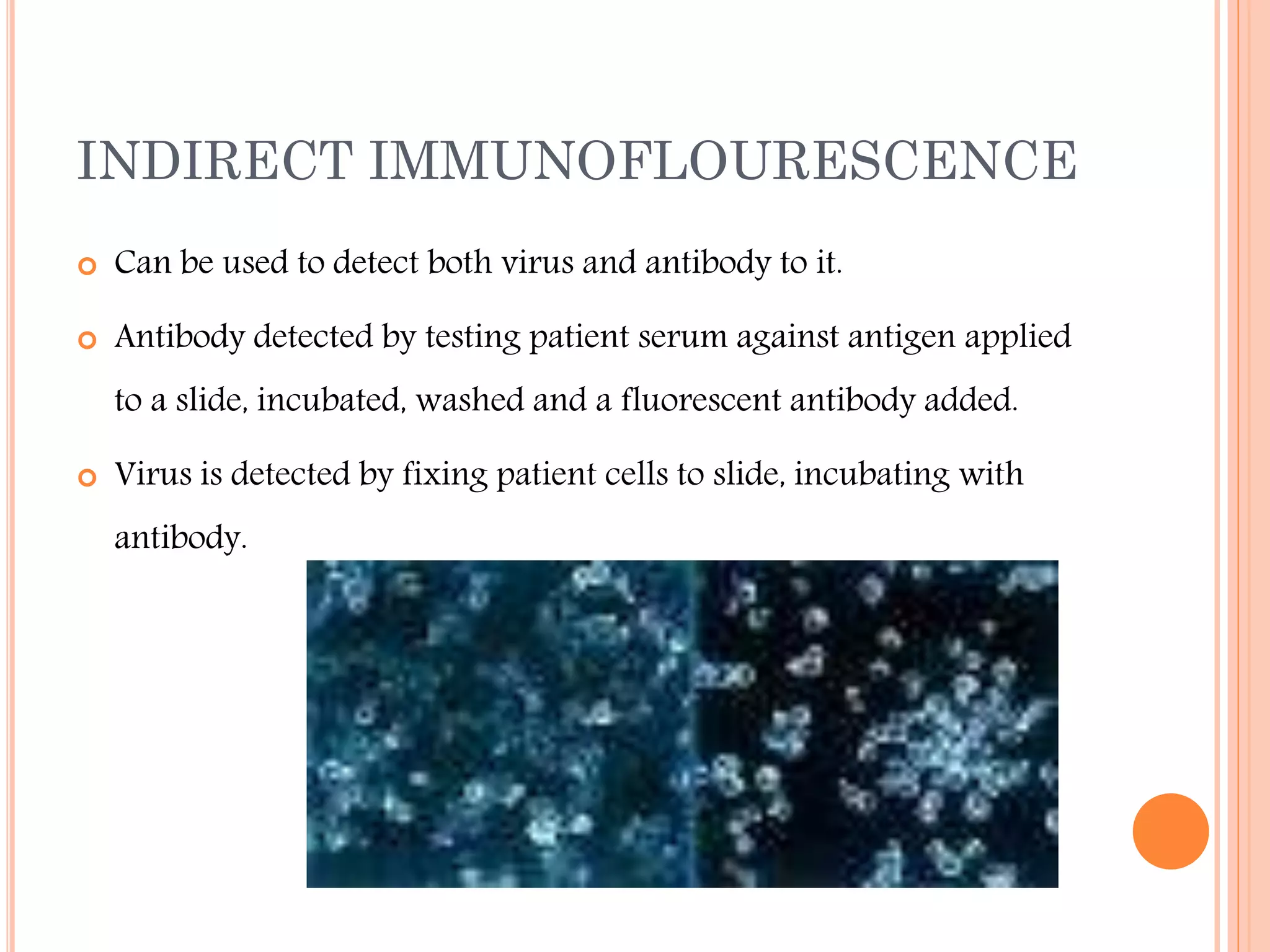 INDIRECT IMMUNOFLOURESCENCE


Can be used to detect both virus and antibody to it.



Antibody detected by testing patient serum against antigen applied
to a slide, incubated, washed and a fluorescent antibody added.



Virus is detected by fixing patient cells to slide, incubating with
antibody.

 
