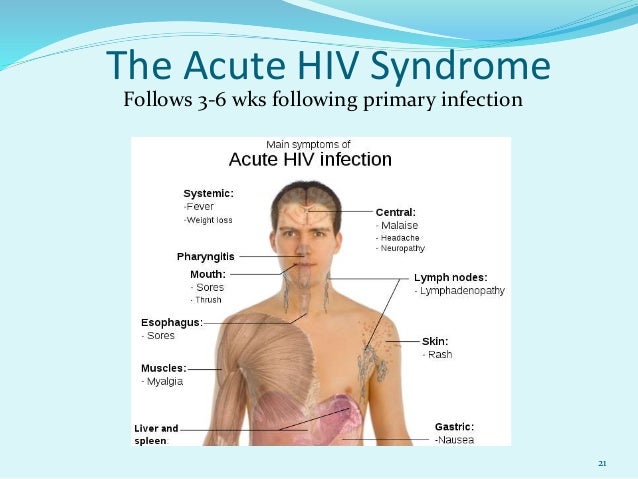 hiv aids swollen lymph nodes hiv