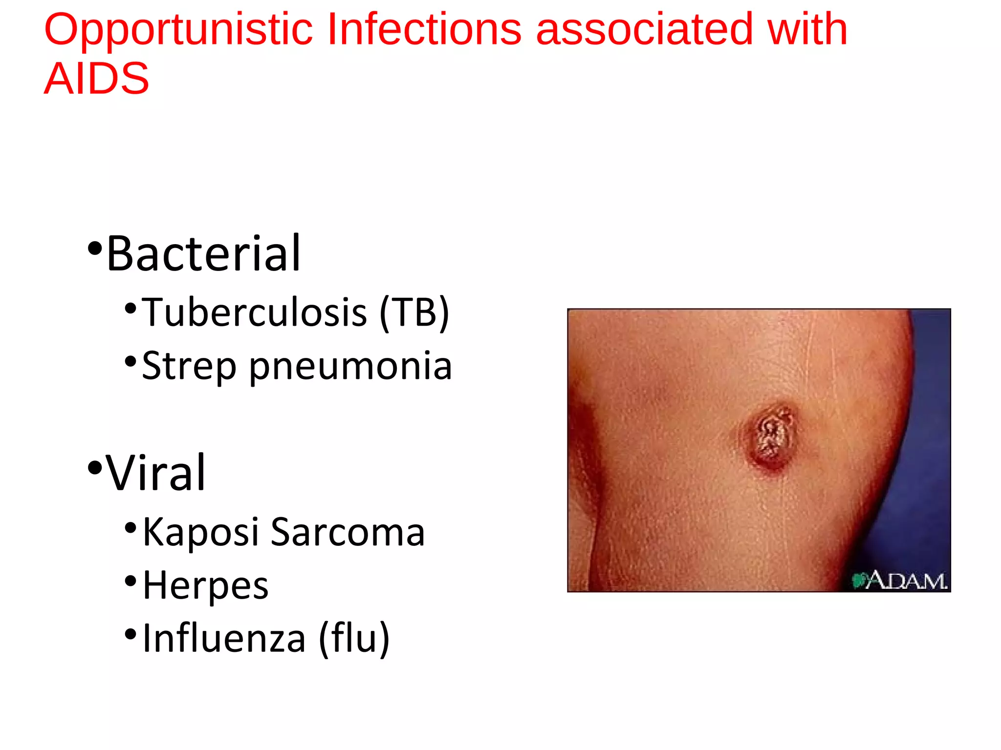 Opportunistic Infections associated with
AIDS
•Bacterial
•Tuberculosis (TB)
•Strep pneumonia
•Viral
•Kaposi Sarcoma
•Herpes
•Influenza (flu)
 
