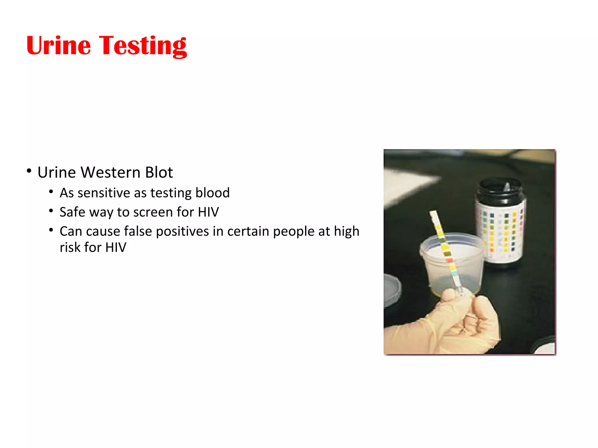 Urine Testing
• Urine Western Blot
• As sensitive as testing blood
• Safe way to screen for HIV
• Can cause false positives in certain people at high
risk for HIV
 