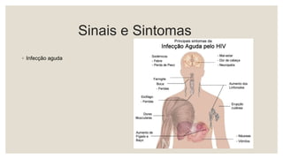 Sinais e Sintomas
◦ Infecção aguda
 